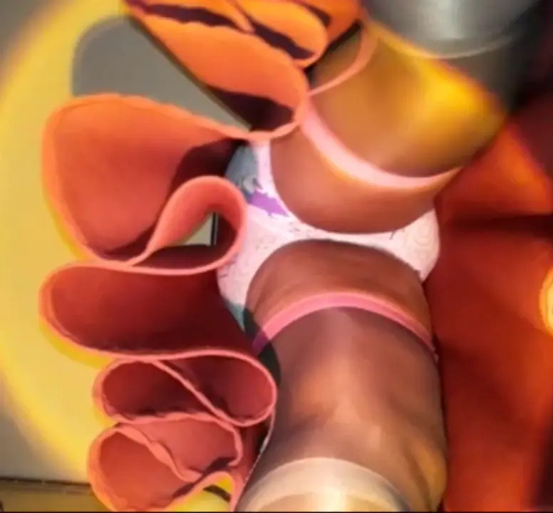 Watch BlueGirl70 Spotlight Upskirt Shemale Porn Videos | TranSexBig.